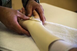 splint hand