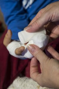 child, boy, injury-2737062.jpg